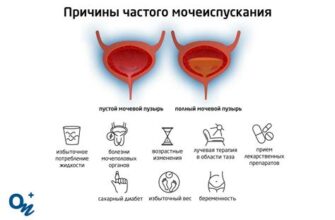 Боль в промежности и частое мочеиспускание при простатите