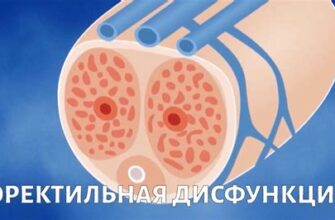 Эректильная дисфункция от первых признаков до похода к врачу