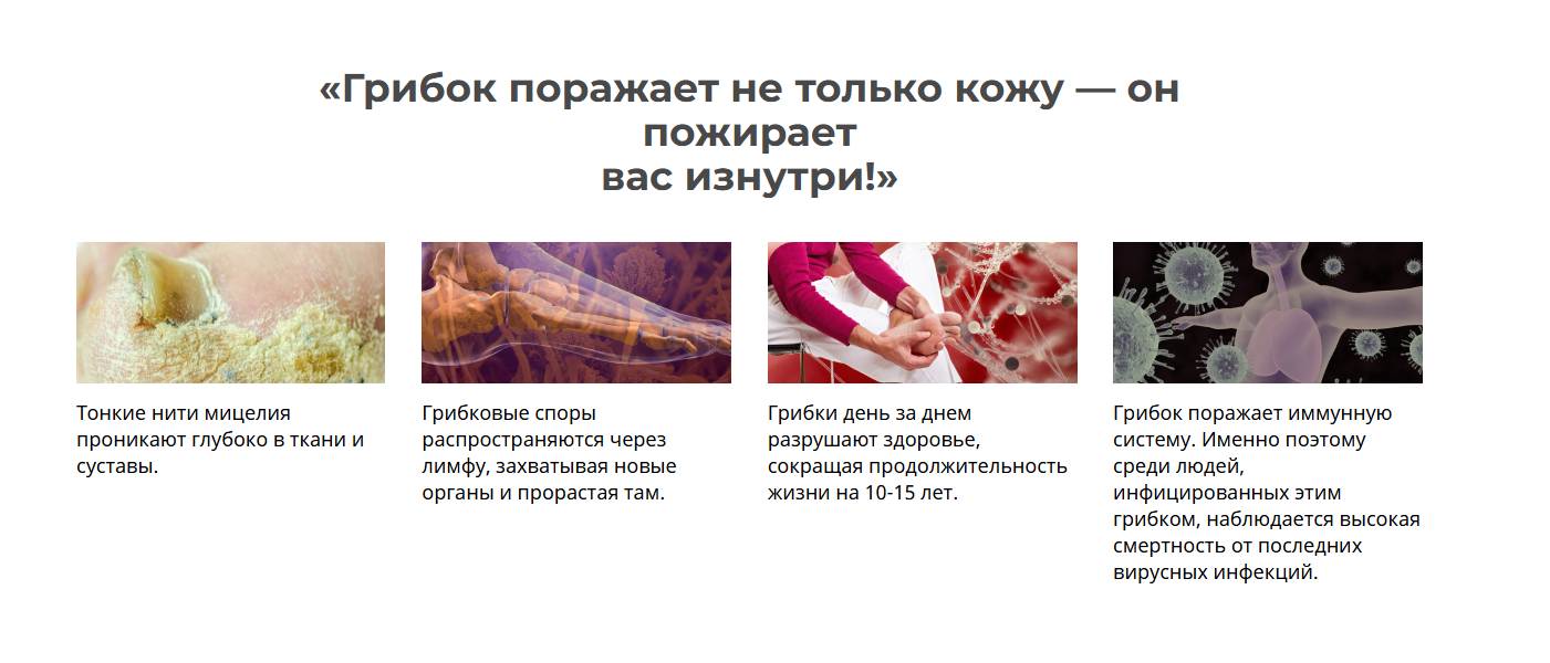 Zinderm